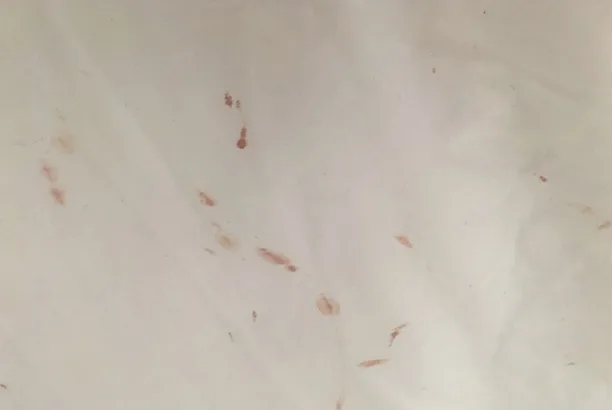 Bed Bug blood trails